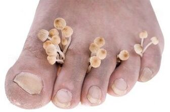 Pilze an den Füßen
