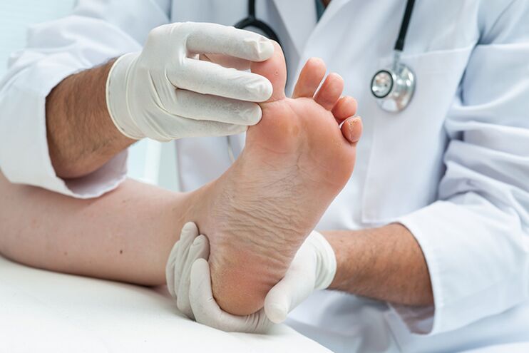 Der Dermatologe untersucht die Beine des Patienten